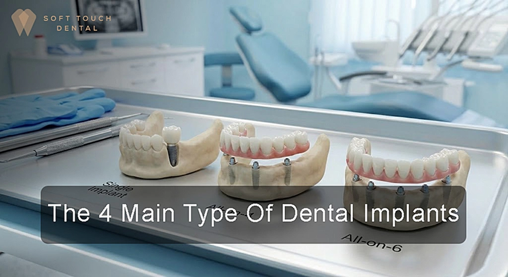 dental implant types