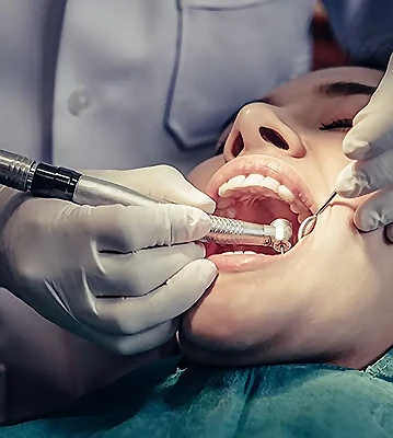 Professional Wisdom Teeth