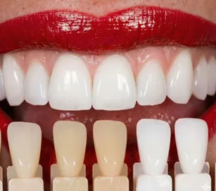 achieving uniformity veneer