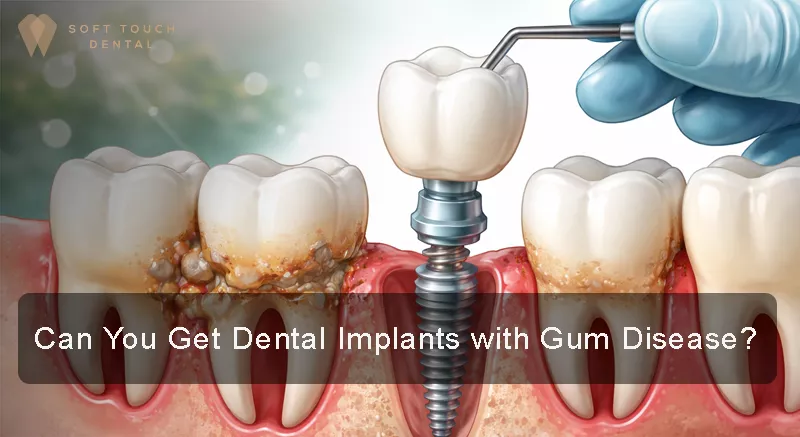 Can I get implants with gum disease?