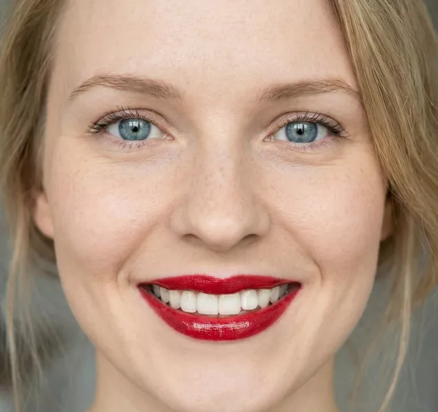 How Long Do Veneers Last
