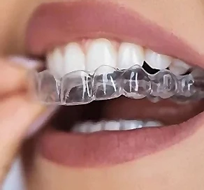 Virtually Invisible Invisalign