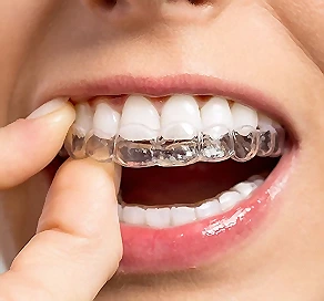 Fewer Appointments Invisalign