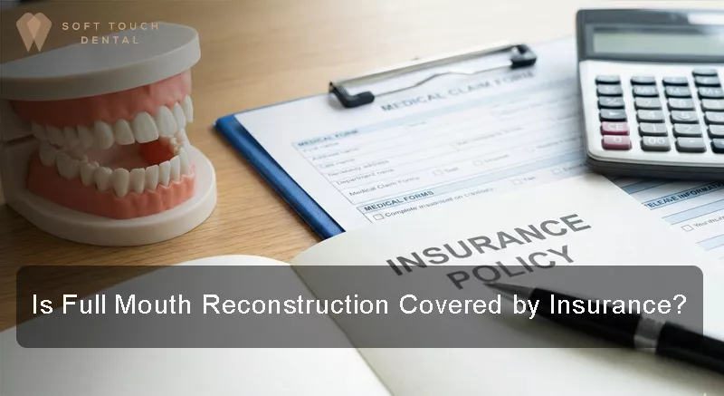 Full mouth rehab coverage