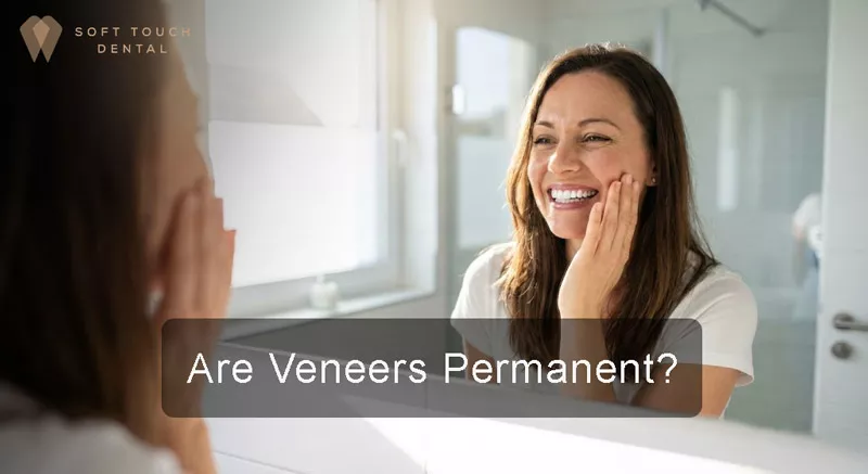 are porcelain veneers Permanent?