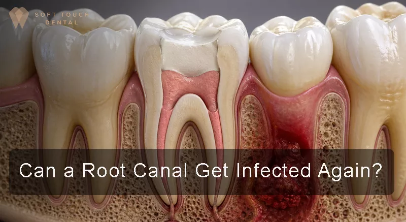 can a root canal get infected again