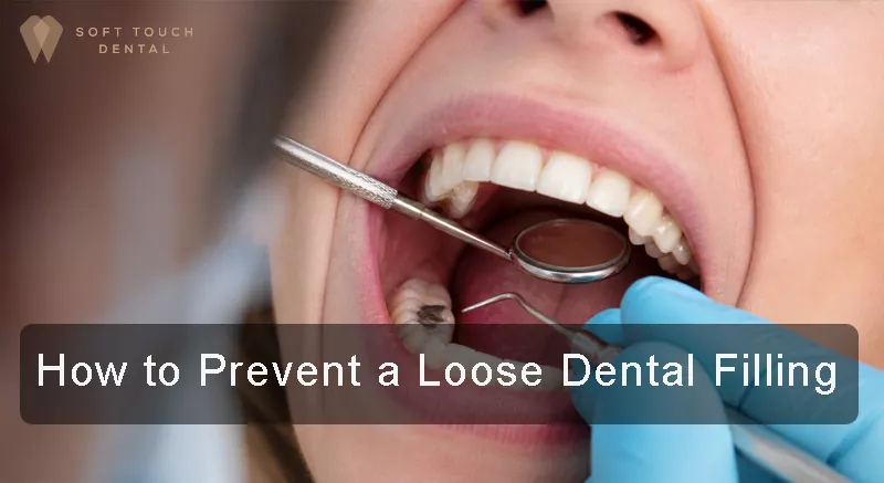 How to Prevent a Loose Dental Filling