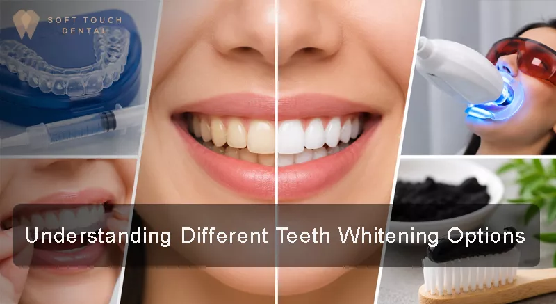 Teeth Whitening Options