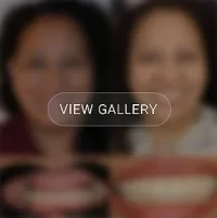 View the before and after gallery