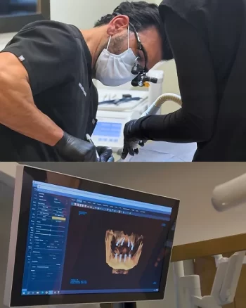 Implant Placement + Same-Day Temporary Teeth