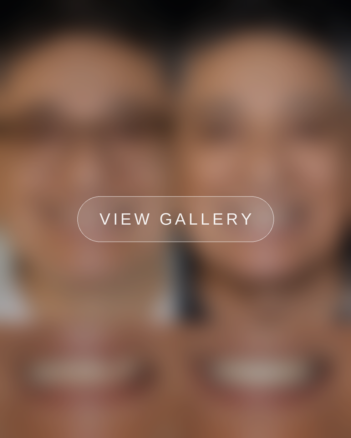BA12 blurred viewgallery