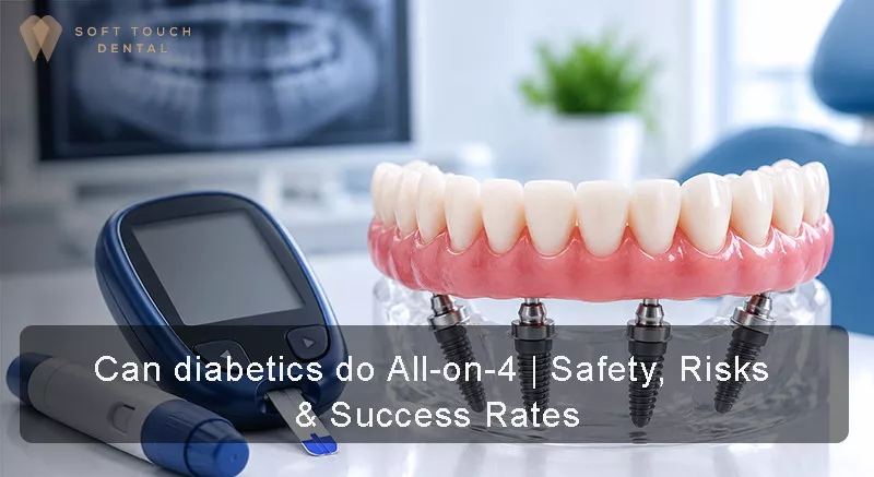 All-on-4 Dental Implants for Diabetes