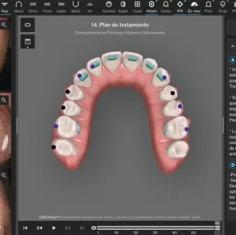 Review Your Smile Plan