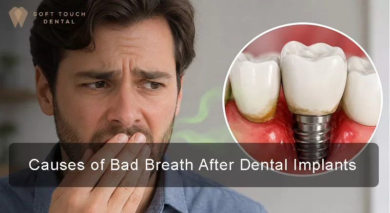 Bad Breath After Dental Implants