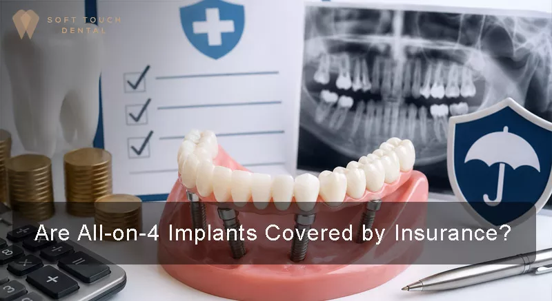 Does All-on-4 Implants Covered by Insurance?