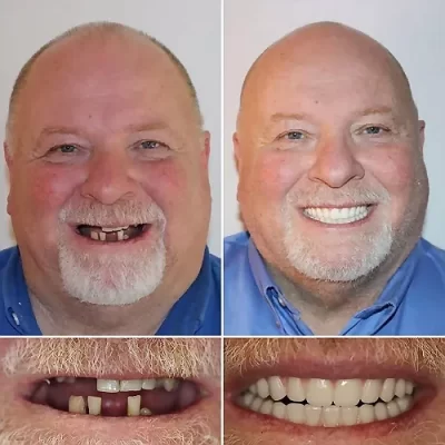 implantt portolio1 M 1 e1784367759583
