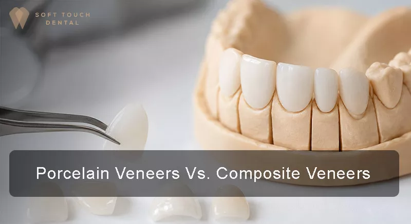 porcelain veneers and composite veneers