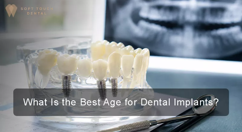 Best Age for Dental Implants