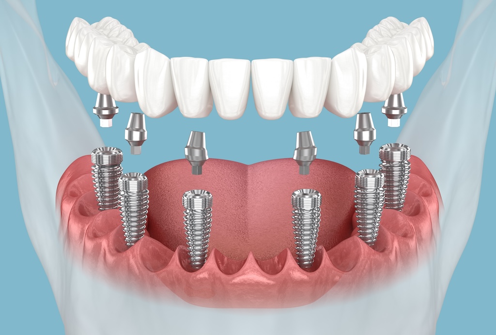 Personalized Treatment Plan